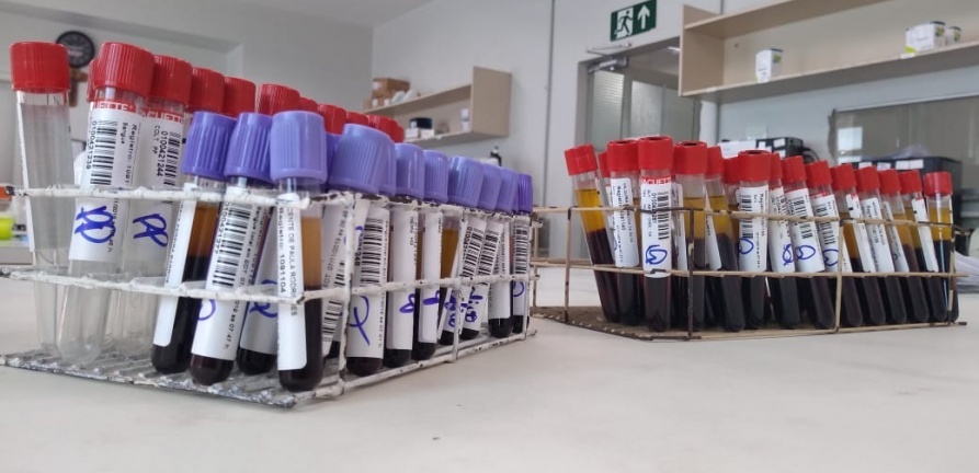 Exames de dengue sem burocracia e com preço reduzido