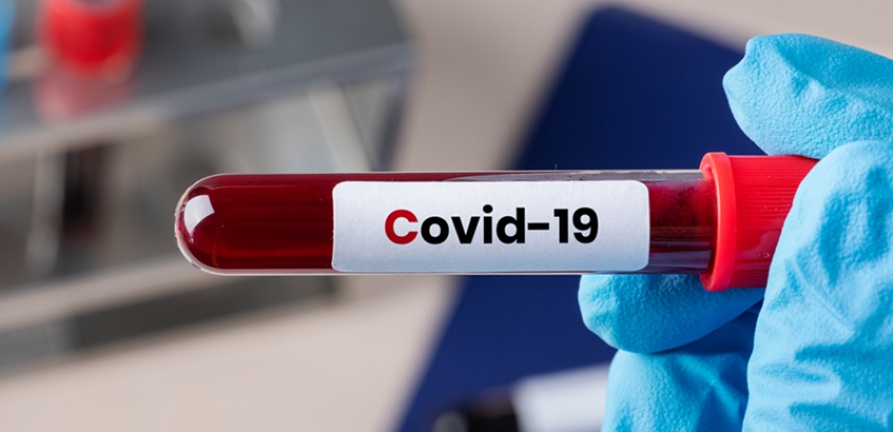 Faça seu exame de Covid-19 no Laboratório do HNSC