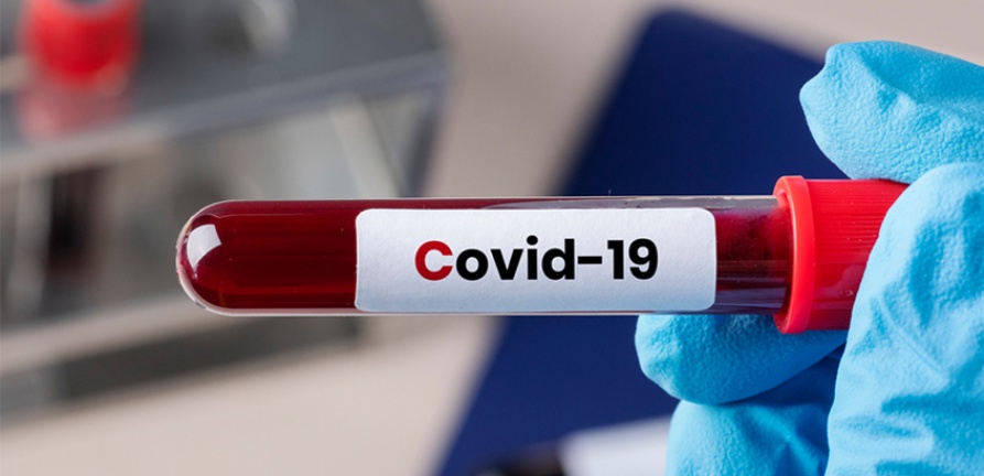 Laboratório do HNSC oferece exames pós-covid-19 e pós-vacinal