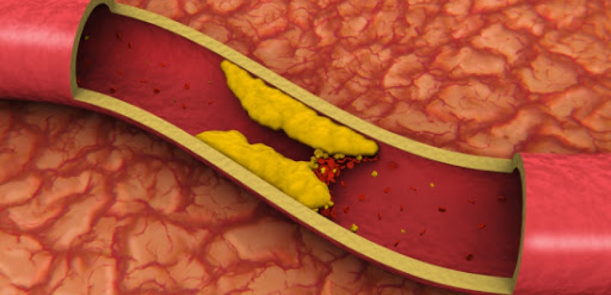 Colesterol: bom ou ruim para o funcionamento do organismo?