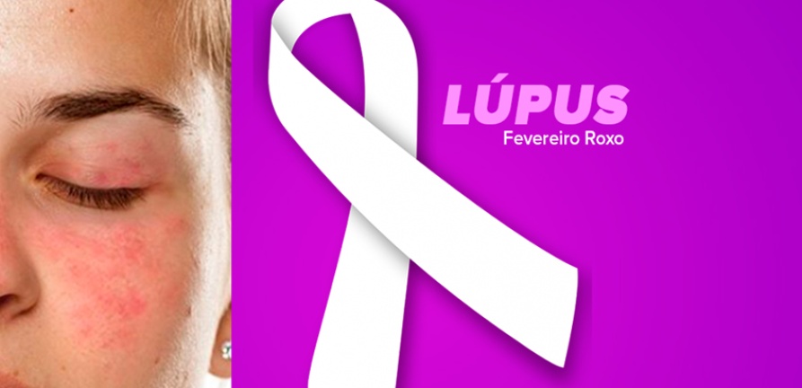 Lúpus: conheça a doença e seus sintomas